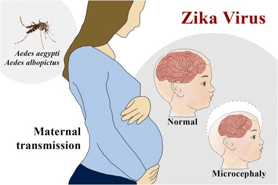 zika virus